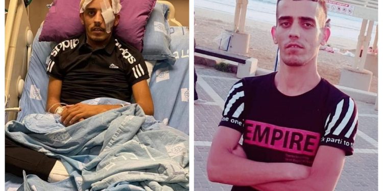 Hamza Abu Sneneh, 30, from the Old City of Jerusalem, was wounded by an Israeli rubber-coated bullet on May 7, 2021, when Israeli occupation soldiers stormed the holy site as thousands of worshipers were performing Taraweeh prayers during the holy month of Ramadan.
