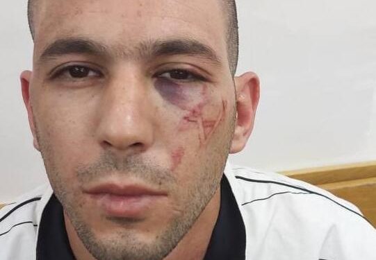 A Palestinian man who was arrested by the Israeli occupation forces and had a Star of David symbol branded on his face has been released to house arrest by an Israeli court on Sunday. The court said that the release was due to the Israeli police’s misconduct and the lack of evidence for the drug smuggling charges against him.
