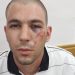 A Palestinian man who was arrested by the Israeli occupation forces and had a Star of David symbol branded on his face has been released to house arrest by an Israeli court on Sunday. The court said that the release was due to the Israeli police’s misconduct and the lack of evidence for the drug smuggling charges against him.