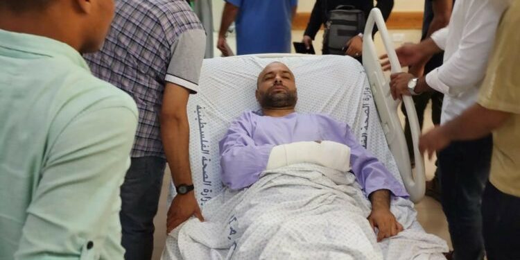 Photojournalist Abu Amira: “I Lost My Hand’s Sensation”