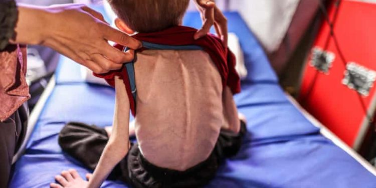 Famine is Now Present in Gaza, US Says