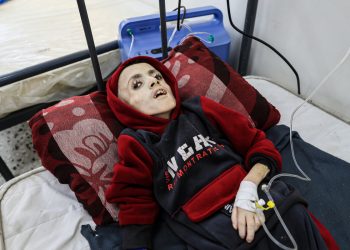 Surge in Child Malnutrition as Gaza Crisis Deepens