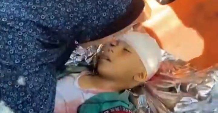 Israeli Missiles On UN School Directly Kill 40 Displaced Palestinians