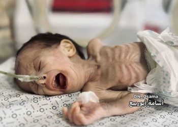Gazans Undergo Catastrophic Levels of Hunger  Philippe Lazzarini, t