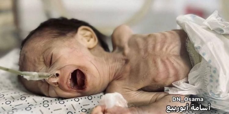 Gazans Undergo Catastrophic Levels of Hunger  Philippe Lazzarini, t