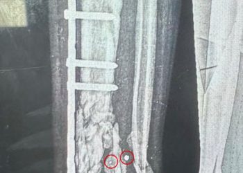 Israeli Munitions Designed to Cause Massive Injuries, The Guardian Says