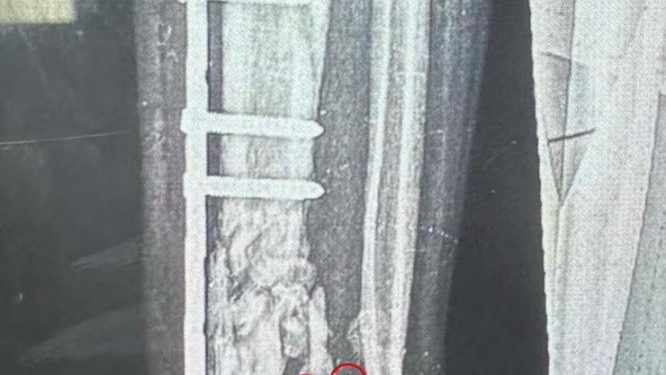 Israeli Munitions Designed to Cause Massive Injuries, The Guardian Says