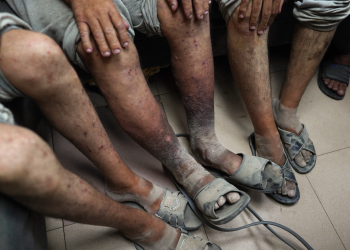 UN: Palestinians Face Beatings, Electric shocks, Sexual Violence in Israeli Custody