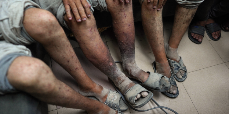 UN: Palestinians Face Beatings, Electric shocks, Sexual Violence in Israeli Custody