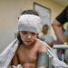 WHO: Over 22500 have suffered ‘life-changing injuries’ in Gaza