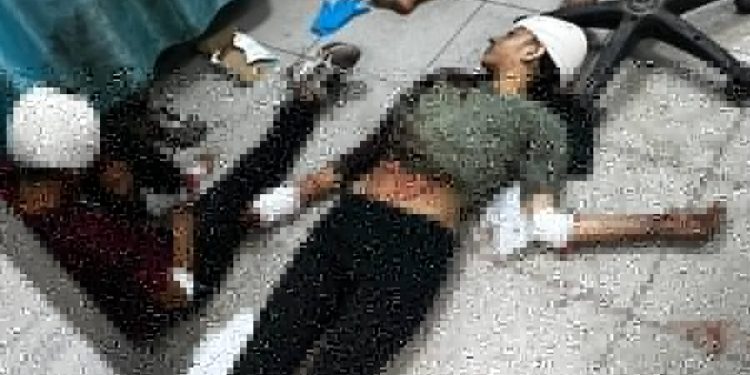 150 Killed in Major Israeli Massacre in Jabalia