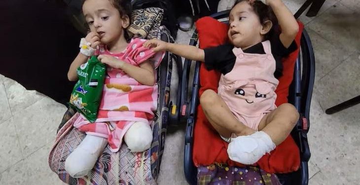 More than 10,000 children in Gaza face life with lost limbs