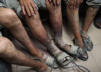 IPS Allows Scabies to Spread Among Palestinian Detainees, Haaretz Uncovers 