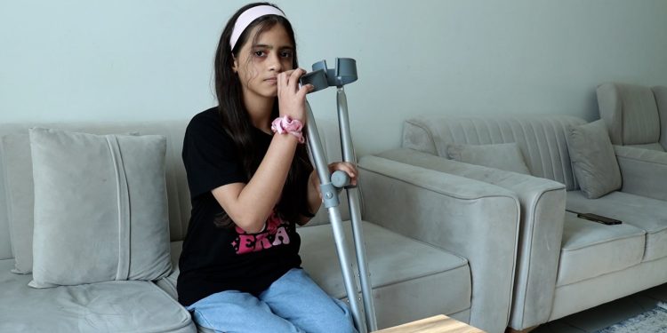 Gaza Becomes Home for Pandemic of Disabilities, UN Warns