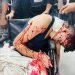 Israeli army hits North Gaza’s last functioning hospital