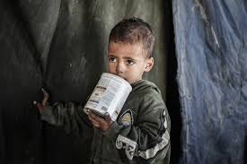 Gaza’s Infants Suffer Amid Israeli Blockade, Starvation