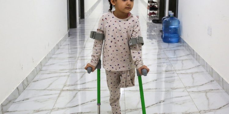 Nearly 30% of Amputees in Gaza Are Women, Children: Health Officials
