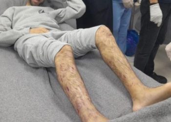 PPC: Freed Palestinian Prisoners Face Severe Abuse, Medical Neglect