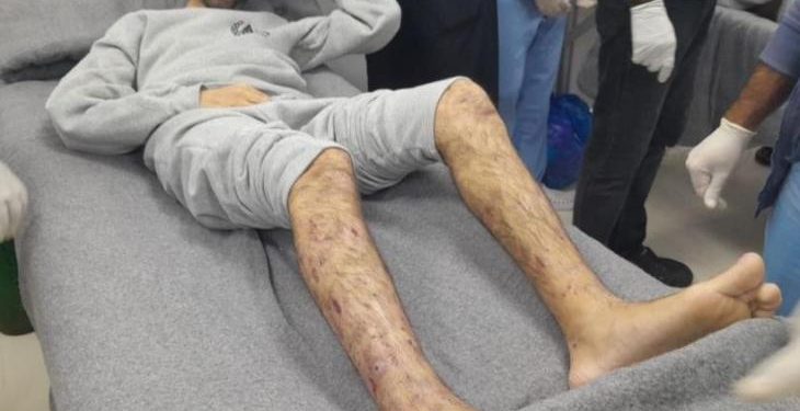 PPC: Freed Palestinian Prisoners Face Severe Abuse, Medical Neglect