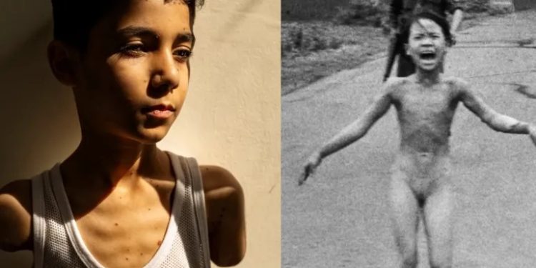 From Gaza to Vietnam: The Power and Limits of a Photograph