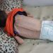UNRWA: 66K Children in Gaza Suffering from Severe Malnutrition