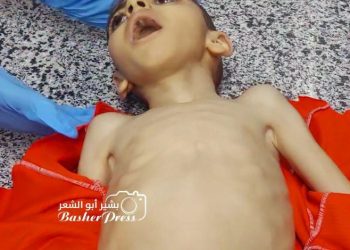  4-Year-Old Mustafa Dies of Hunger as Starvation Crisis Deepens