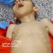  4-Year-Old Mustafa Dies of Hunger as Starvation Crisis Deepens