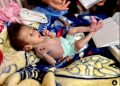Baby Yousef Fights for Life with no Milk available