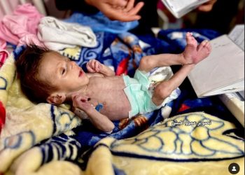Baby Yousef Fights for Life with no Milk available