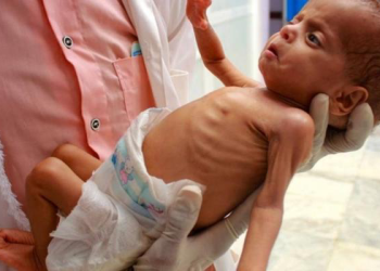 66 Children Dead from Starvation in Gaza