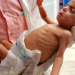 66 Children Dead from Starvation in Gaza