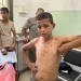 Wounds of War: Gaza’s Children Battle Skin Diseases Without Medicine