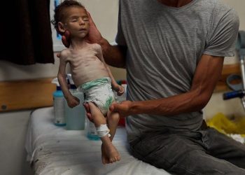 At Least 15 Die from Starvation in Gaza in 24 Hours