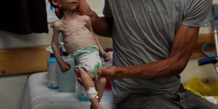 At Least 15 Die from Starvation in Gaza in 24 Hours