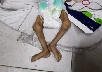 Israel’s Blockade Escalates Gaza Malnutrition Crisis, WHO Warns