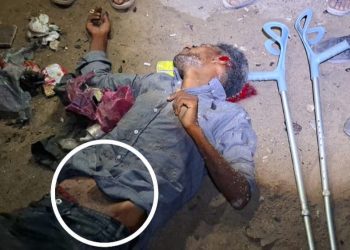 Dozens of Displaced People Killed, Injured in Shati’ Camp Bombing