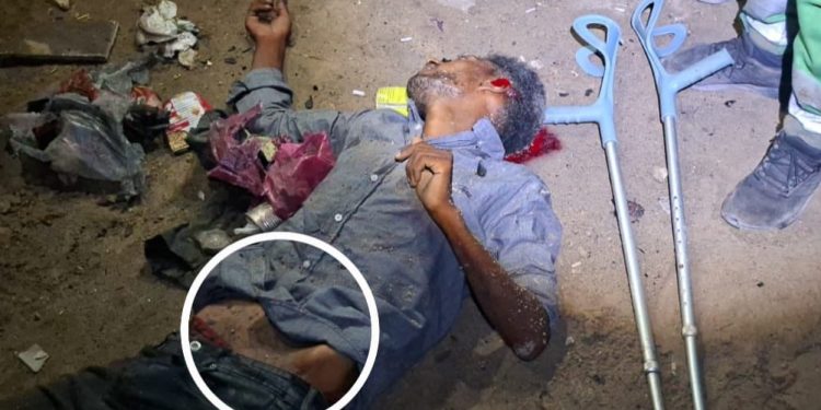 Dozens of Displaced People Killed, Injured in Shati’ Camp Bombing