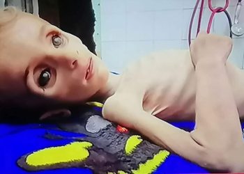 Infants Dying of Starvation in Gaza Amid Severe Famine, Inte’l Warnings