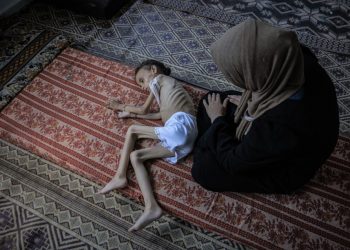 Starving Children ‘Hunted for Food, US Doctor in Gaza Warns