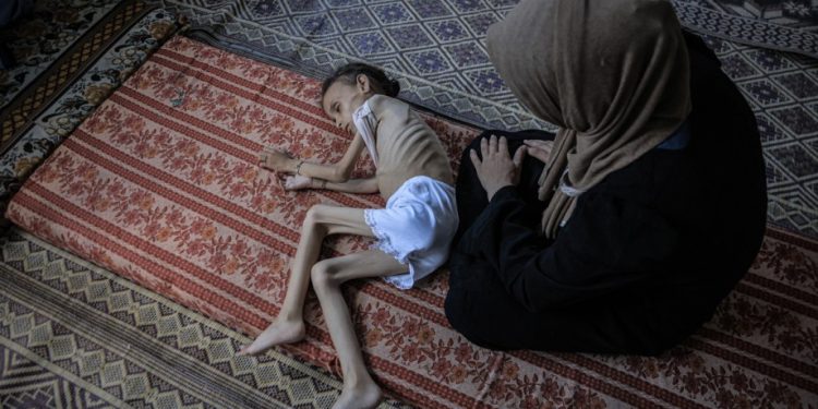 Starving Children ‘Hunted for Food, US Doctor in Gaza Warns