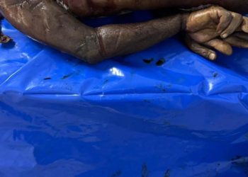 Bodies Received show Organ Theft, Torture Marks, Burn Injuries and field Execution