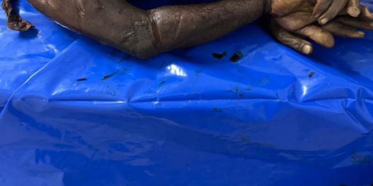 Bodies Received show Organ Theft, Torture Marks, Burn Injuries and field Execution