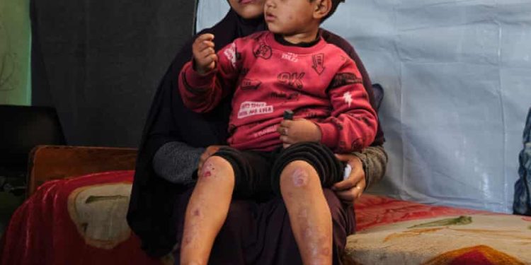 Gaza Cancer Patients Trapped Without Treatment Under War, Blockade