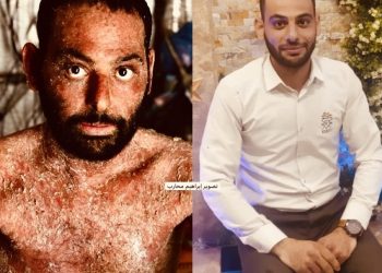 Rare Skin Disease Threatens Displaced Palestinian Man in Gaza