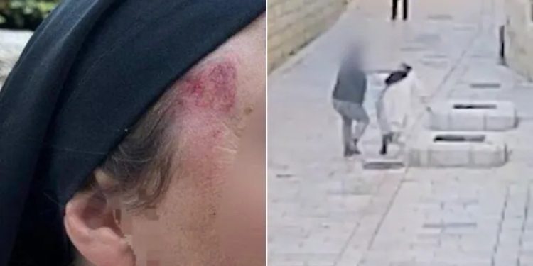 French Outrage Erupts After  Settler Assault on Nun in Jerusalem