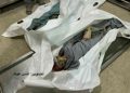Burned Child Survives Gaza Strike with Entire Family Killed