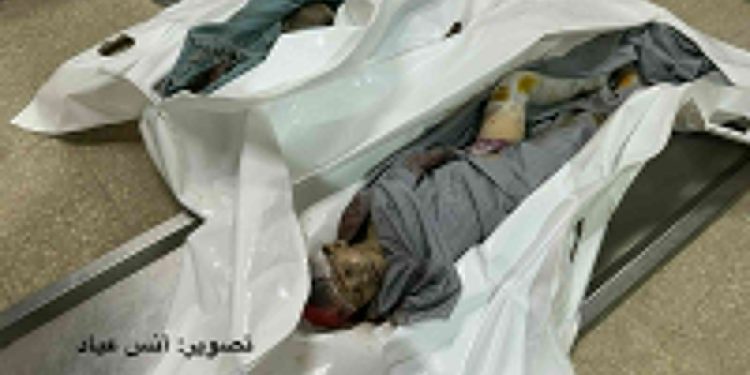 Burned Child Survives Gaza Strike with Entire Family Killed