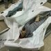 Burned Child Survives Gaza Strike with Entire Family Killed