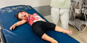 Eight Palestinians Killed, 26 Injured in Latest Israeli Attacks on Gaza