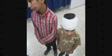Two Palestinian Children Injured in West Bank Settler Stone-Throwing Attack